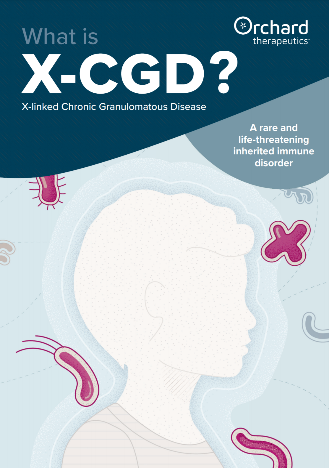 Cos'è X-CGD?